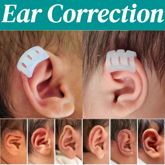 baby ear corrector